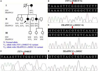 Digenic Variants in the TTN and TRAPPC11 Genes Co-segregating With a Limb-Girdle Muscular Dystrophy in a Han Chinese Family